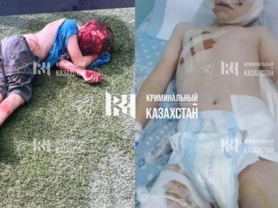Врачи рассказали о состоянии истерзанного собаками мальчика.