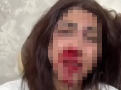Страшное избиение женщины возмутило казахстанцев: бывший муж задержан