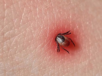 Первый смертельный случай от укуса клеща зафиксирован в Казахстане