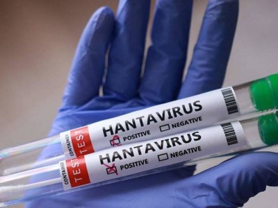 Хантавирус распространяется: первый заражённый выявлен в Канаде