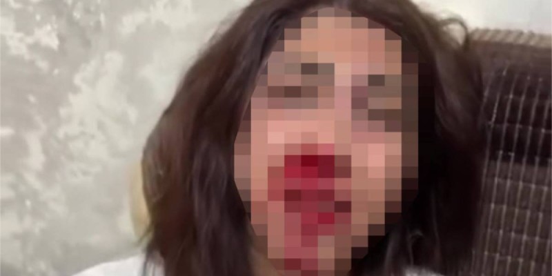 Страшное избиение женщины возмутило казахстанцев: бывший муж задержан