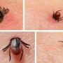 После укуса клеща казахстанцы не смогли найти жизненно важный препарат
