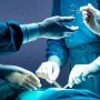 В Уральске врачи извлекли из желудка 10-летней девочки 620 граммов волос